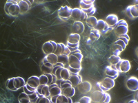 Dunkelfeld-Vitalblutuntersuchung