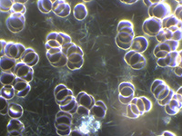 Dunkelfeld-Vitalblutuntersuchung