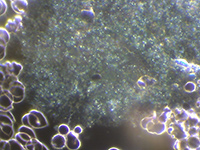 Dunkelfeld-Vitalblutuntersuchung