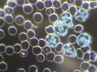 Dunkelfeld-Vitalblutuntersuchung