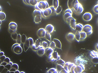 Dunkelfeld-Vitalblutuntersuchung