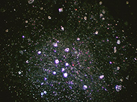 Dunkelfeld-Vitalblutuntersuchung