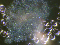 Dunkelfeld-Vitalblutuntersuchung