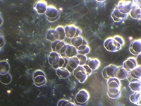 Dunkelfeld-Vitalblutuntersuchung