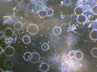 Dunkelfeld-Vitalblutuntersuchung